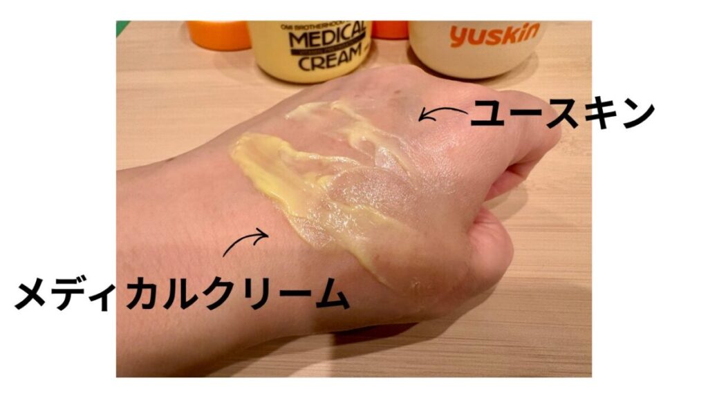 メディカルクリームとユースキンを手に取ったところ